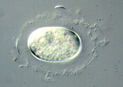 <p><em>Alexandrium catenella</em> cyst - NIMPIS.</p>
