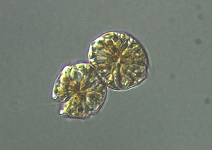 <p><em>Alexandrium catenella </em>cells - NIMPIS.</p>
