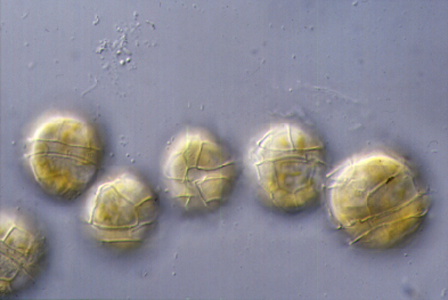 <p><em>Alexandrium minutum </em>cells - NIMPIS.</p>

