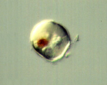 <p><em>Alexandrium minutum </em>cyst - NIMPIS.</p>
