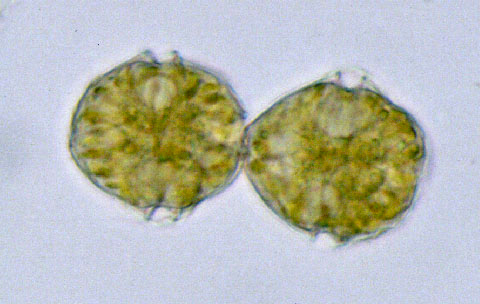 <p><em>Alexandrium tamarense </em>cells - NIMPIS.</p>
