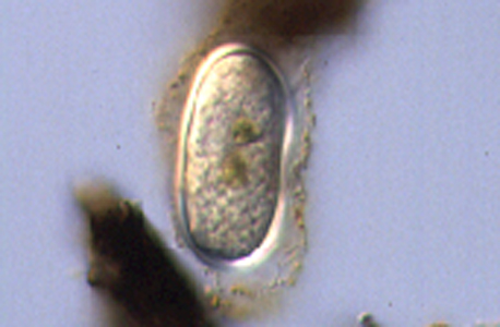 <p><em>Alexandrium tamarense </em>cyst - NIMPIS.</p>
