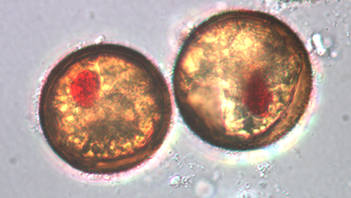<p><em>Gymnodinium catenatum </em>cyst - NIMPIS.</p>
