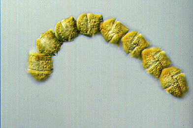 <p><em>Gymnodinium catenatum</em> chain - NIMPIS.</p>
