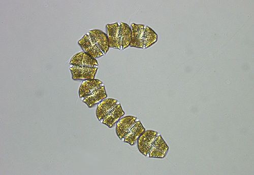 Gymnodinium catenatum chain - NIMPIS.