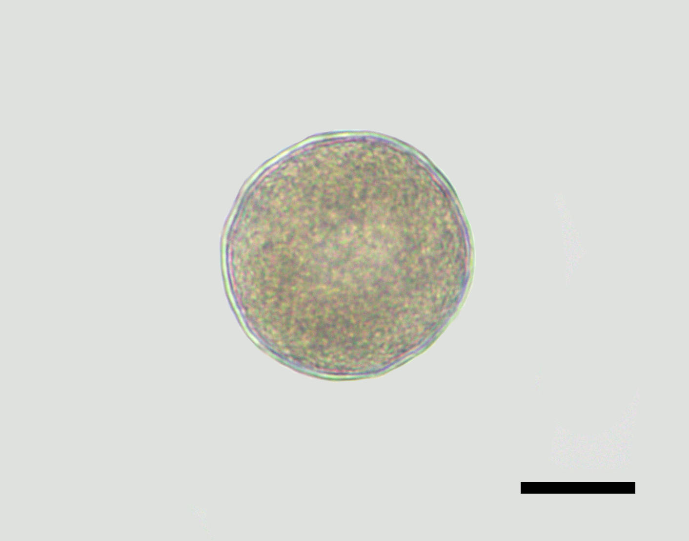 <p><em>Mytella strigata </em>egg&nbsp;</p>
